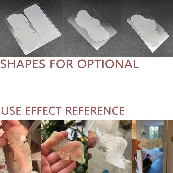 hydrocolloid patches for nose