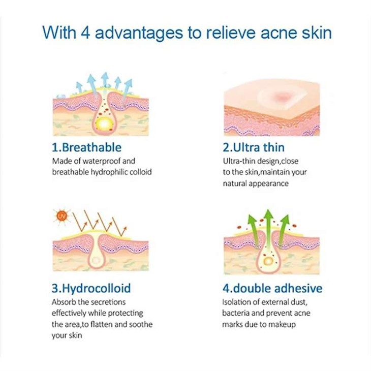 สติ๊กเกอร์สิว